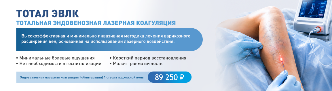 ТОТАЛ ЭВЛК — победа над варикозом за одно лечение!